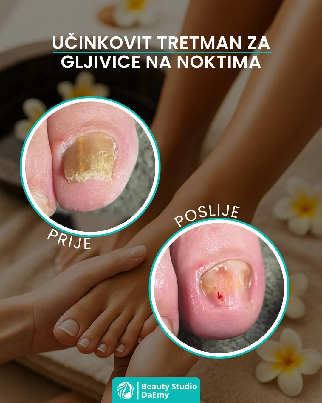 Gljivice